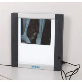 HSX X-RAY Film Viewer