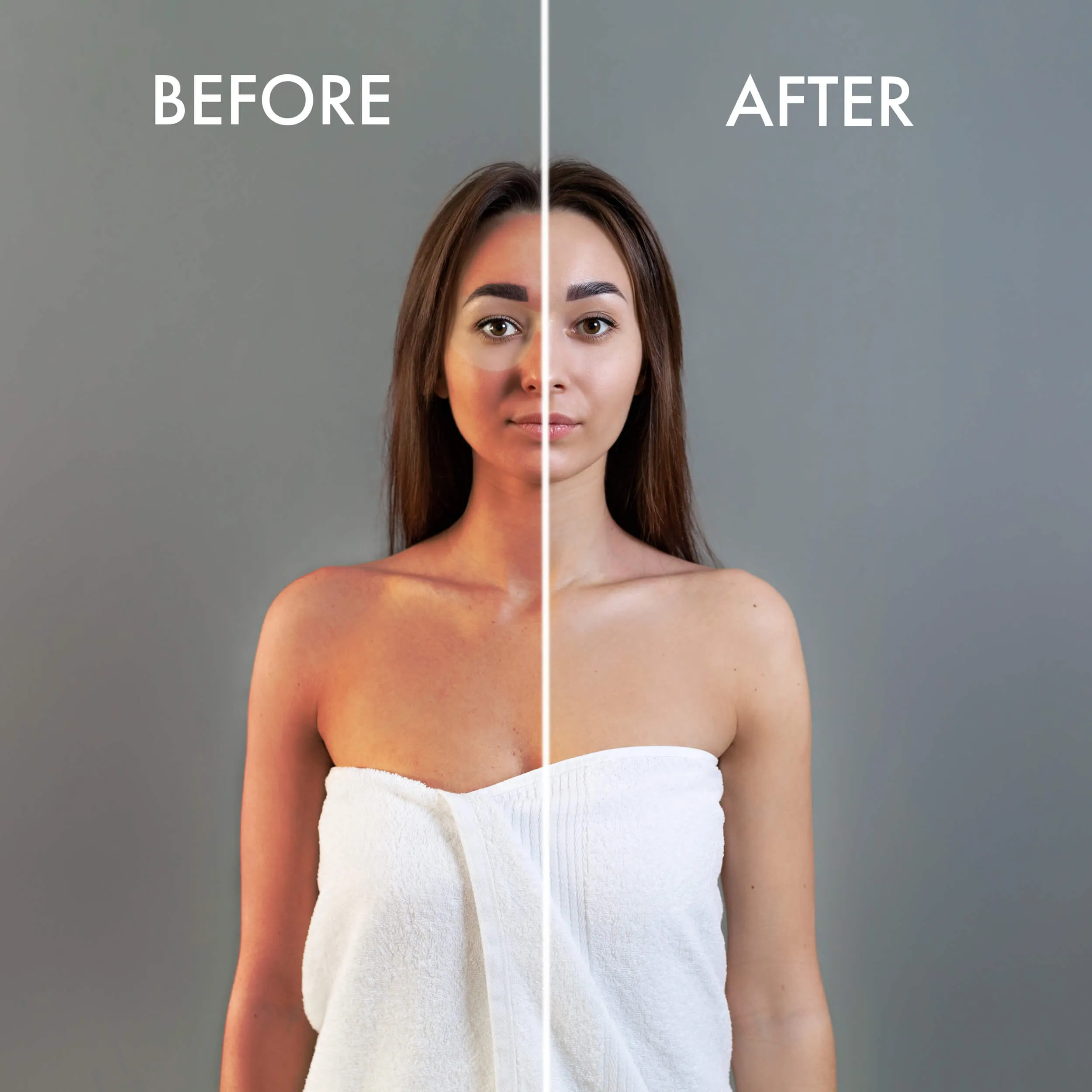 LUMI400II Medical Clinical Wall Mounted Photography Studio Flash Kit (Before and After)