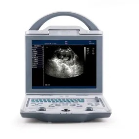 Meubon Animal B-Ultrasound Portable B Mode Equine Veterinary Ultrasound Machine I Model KX-5600